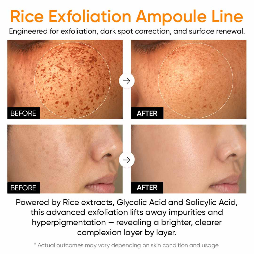 SANUO® Black & White Rice Ampoule Duo